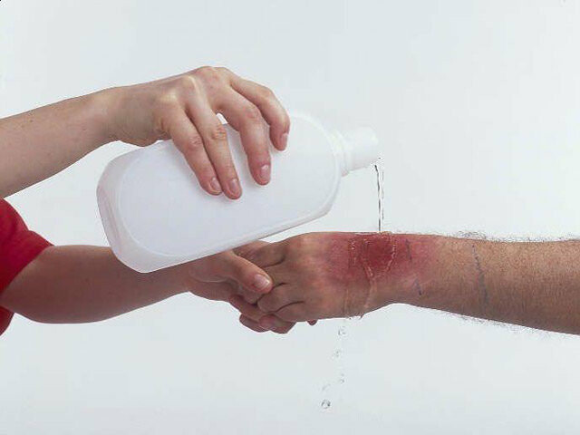  ���������� ��������� ������� �������� ���������� 