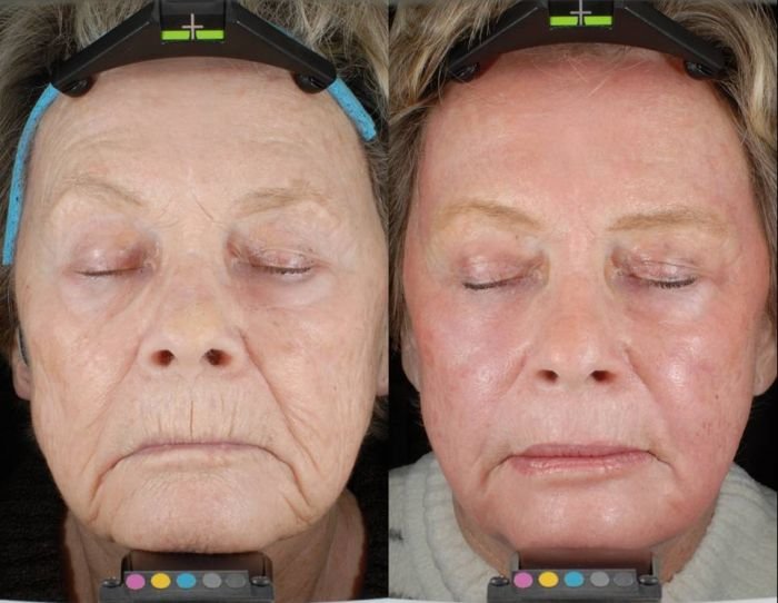 smartskin1
