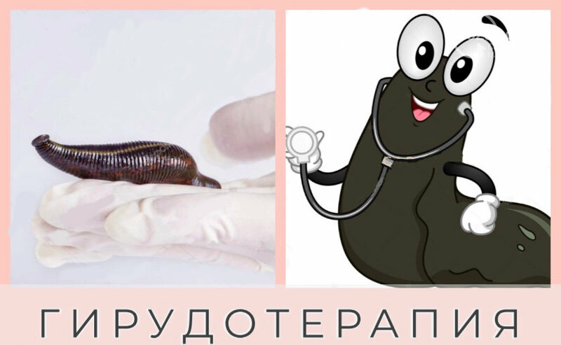 Оздоровительный Spa-центр “Quantum" открывает свои двери д..., фото-10 Оздоровительный Spa-центр “Quantum" открывает свои двери для Мариупольцев, фото-10